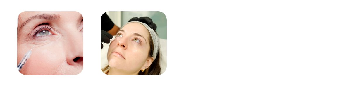 under eye rejuvenation